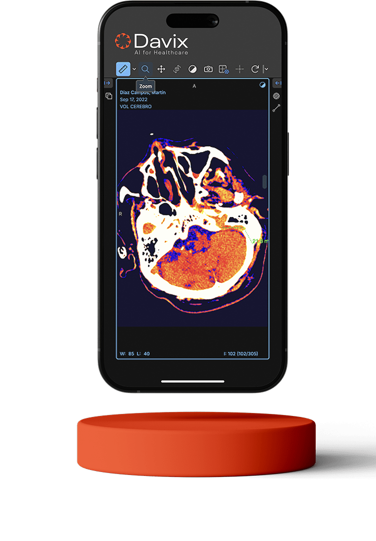 Davix Mobile App